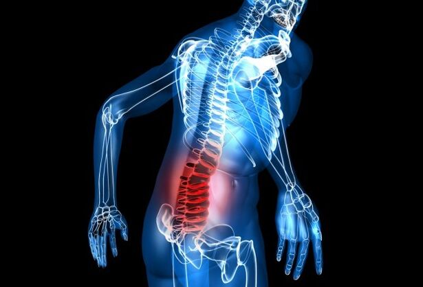 Symptoms of osteochondrosis