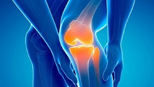 knee arthrosis